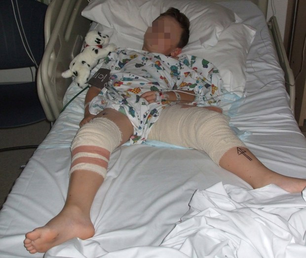 seven year old Christian Hickey in his hospital bed after gunmen blasted the schoolboy and his mother on their doorstep