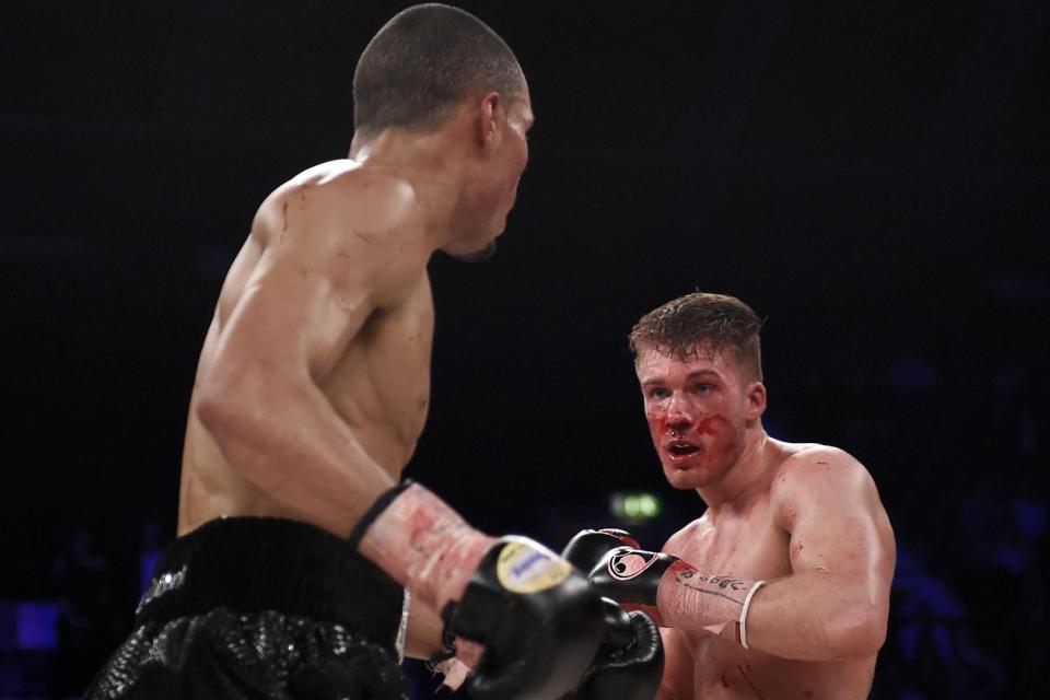  Fighter took rounds of punishment from Eubank Jr before he was stopped