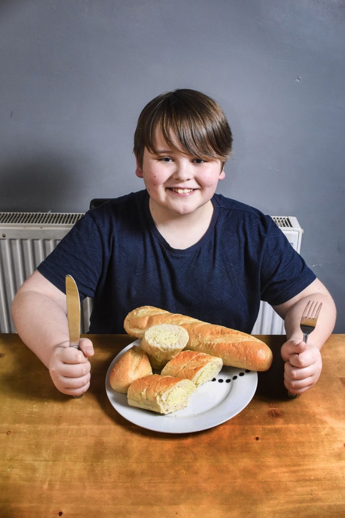  Billy Turner can only eat garlic bread following cancer treatment