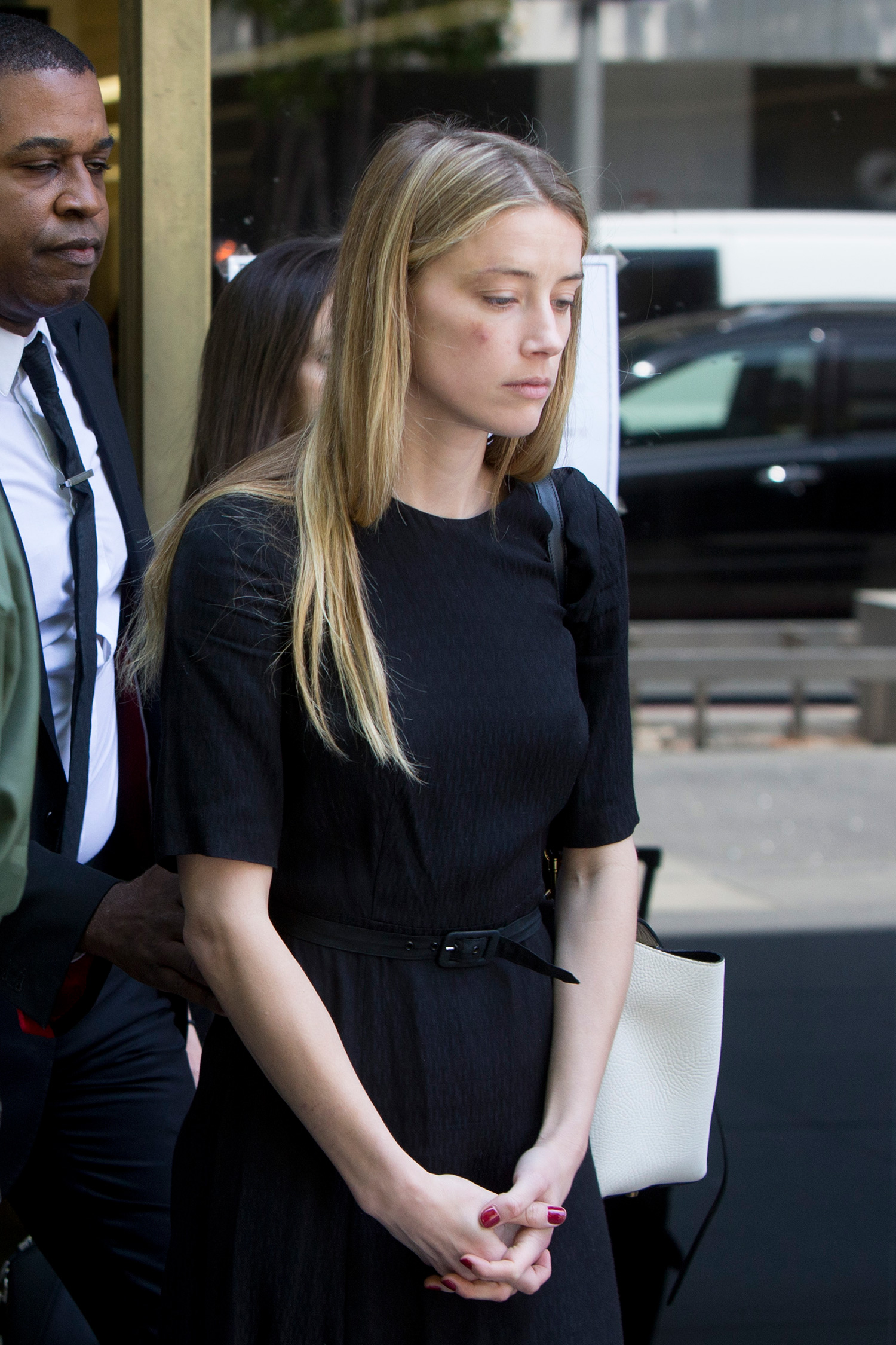 Amber Heard leaves court in Downtown Los Angeles,CA. Amber Heard has been granted a temporary restraining order after accusing her estranged husband Johnny Depp of domestic abuse in a court filing. Amber had obvious bruises on her face and was visibly shaken by the ordeal. Pictured: Amber Heard Ref: SPL1287558 270516 Picture by: Splash News Splash News and Pictures Los Angeles: 310-821-2666 New York: 212-619-2666 London: 870-934-2666 photodesk@splashnews.com¿