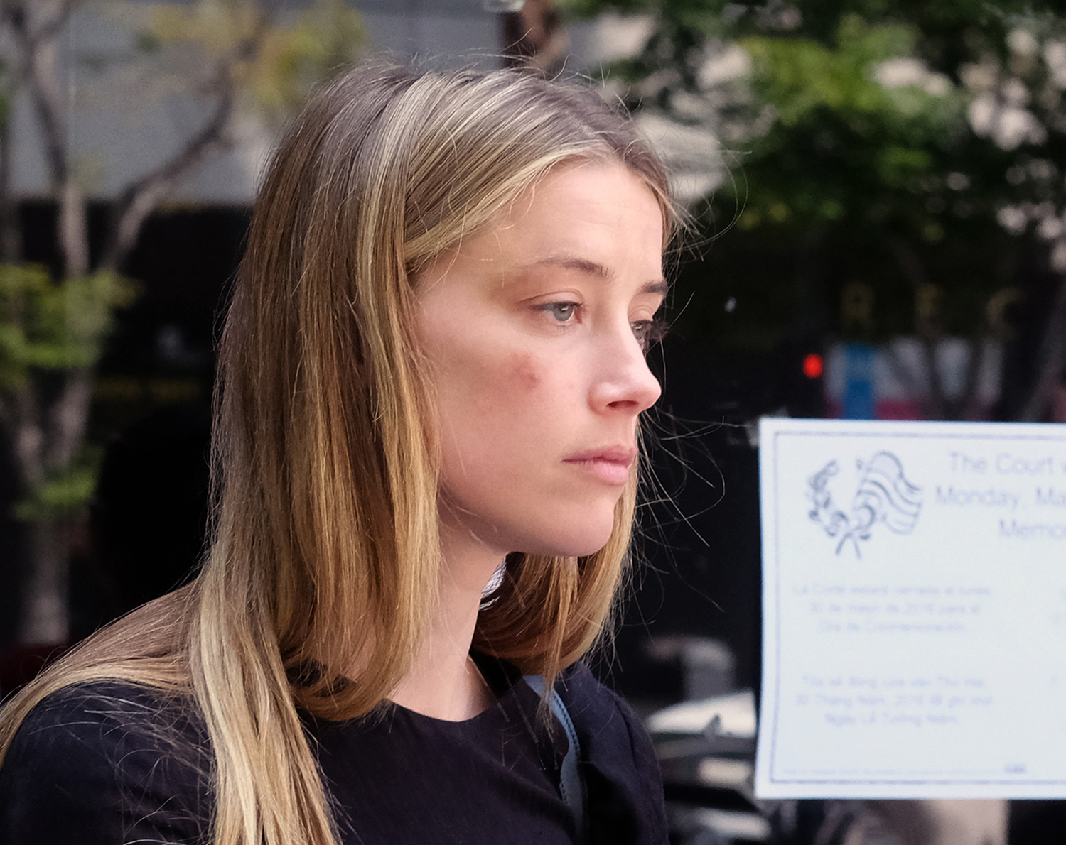 Amber Heard leaves court in Downtown Los Angeles,CA. Amber Heard has been granted a temporary restraining order after accusing her estranged husband Johnny Depp of domestic abuse in a court filing. Amber had obvious bruises on her face and was visibly shaken by the ordeal. Pictured: Amber Heard Ref: SPL1287558 270516 Picture by: Splash News Splash News and Pictures Los Angeles: 310-821-2666 New York: 212-619-2666 London: 870-934-2666 photodesk@splashnews.com¿