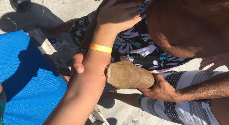 Nurse sharks can grow up 14ft in length. Fortunately for the victim, this one was only a relative tiddler