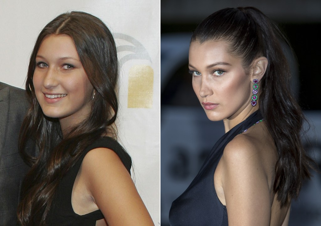 Bella Hadid in 20010 and 2016... has she changed naturally?