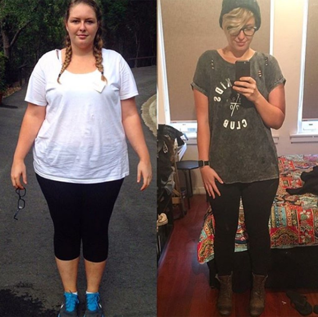 Freya had gastric band surgery, but it made things worse and she put on weight