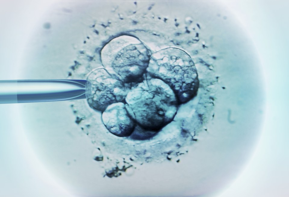  Critics have called the new IVF technique a step towards 'designer babies'