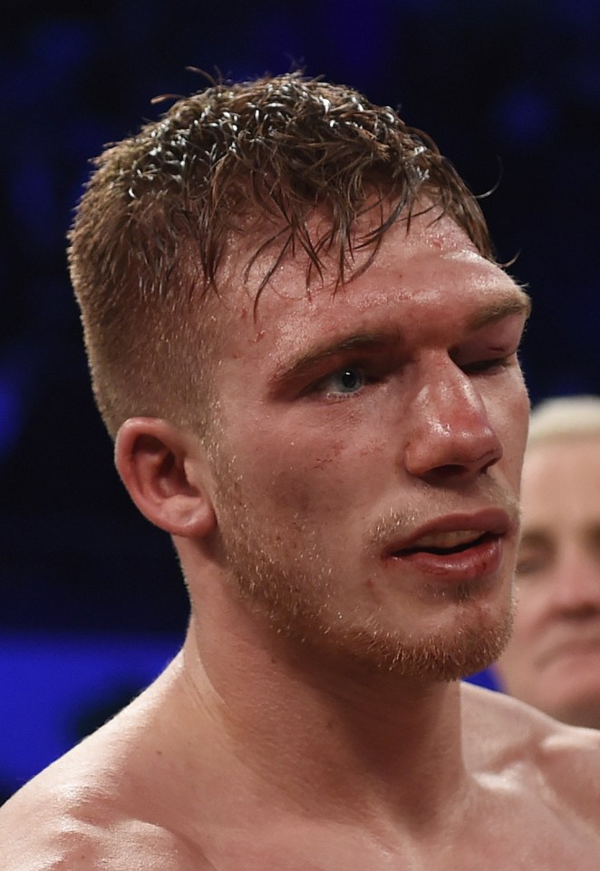  Nick Blackwell ended up in a coma after his fight against Chris Eubank Jnr