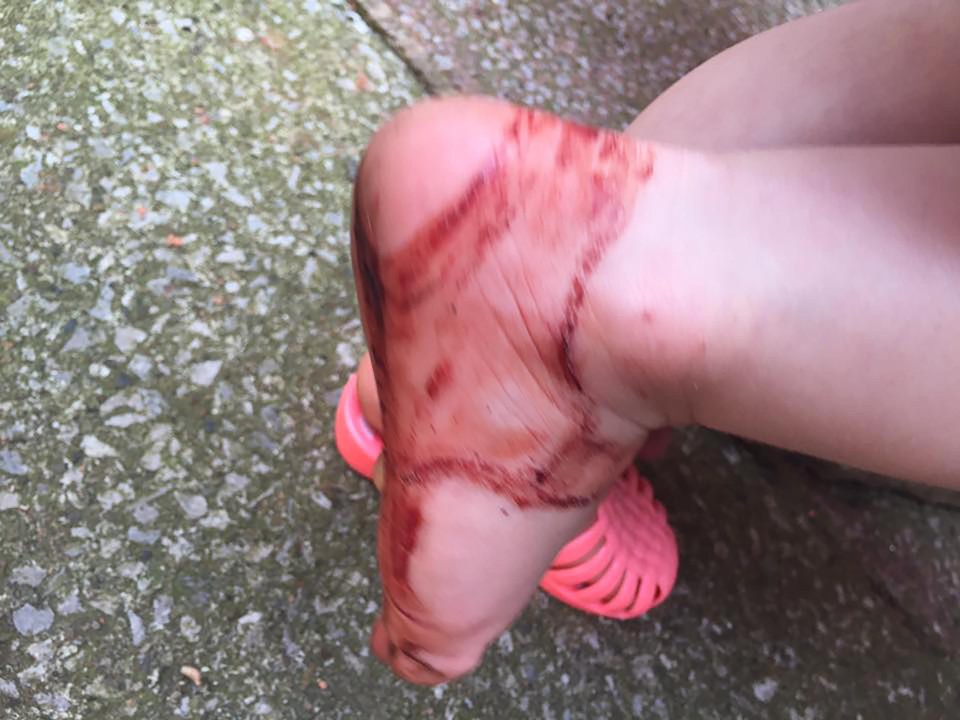  Esme's concerned mum shared photos on social media of her daughter's injuries