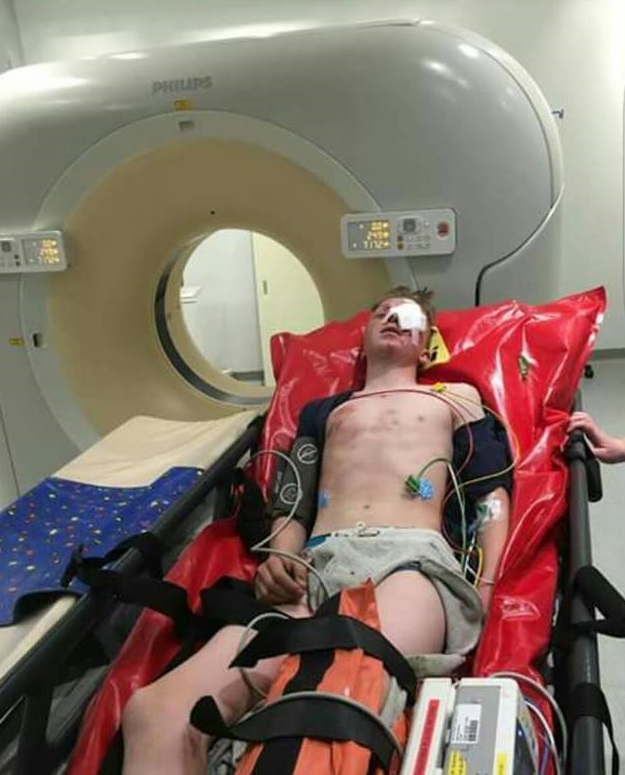  The young boy had to undergo surgery on his eye after he was knocked down by a car in his home town of Warrington