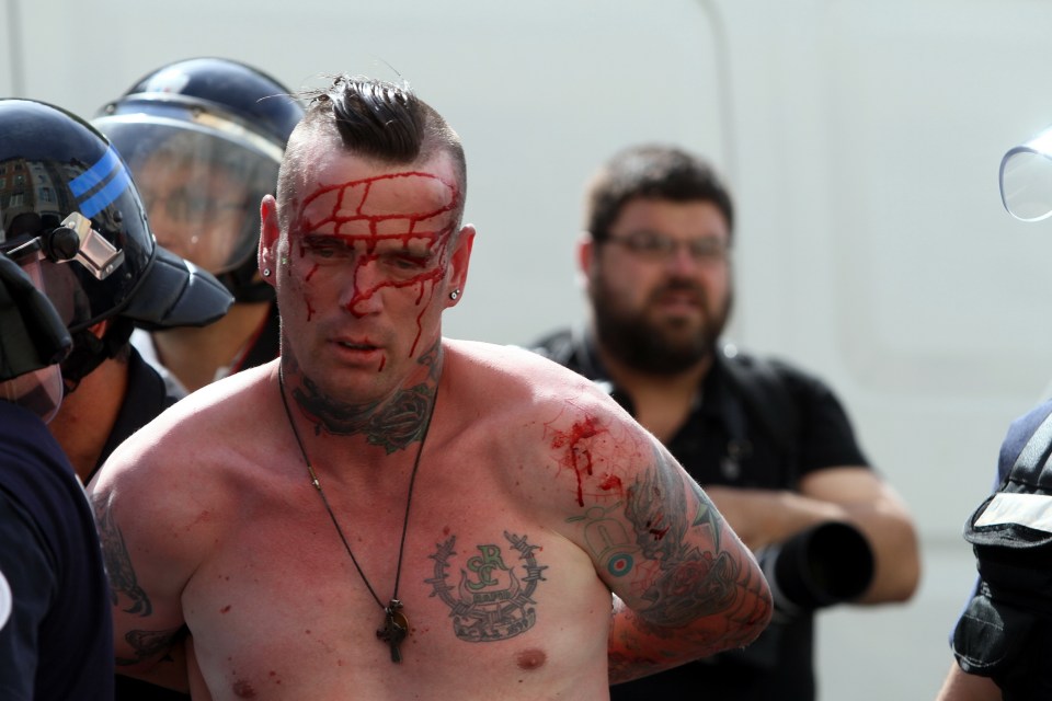  Bloodied hooligan arrested in Marseilles violence has a motor scooter among his many tatts