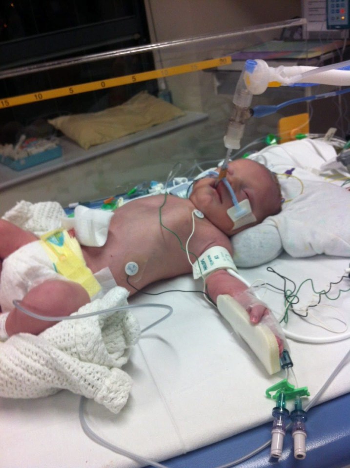  Little Harry died following complications at his birth at the Royal Devon and Exeter Hospital