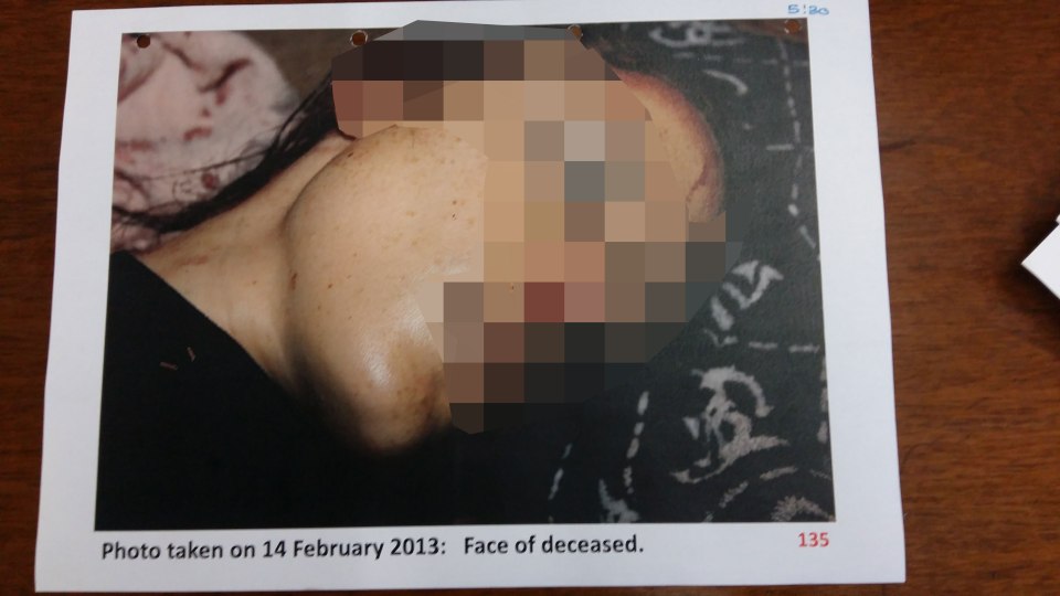  Horrific images have been released which show the full extent of Reeva Steenkamp's gunshot wounds