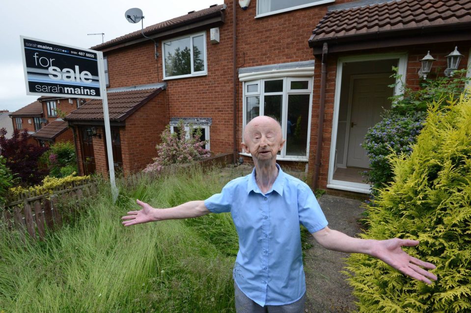  Alan Barnes bought this house with donations given by people touched by the story of his attack, but now he wants to sell it and rent instead