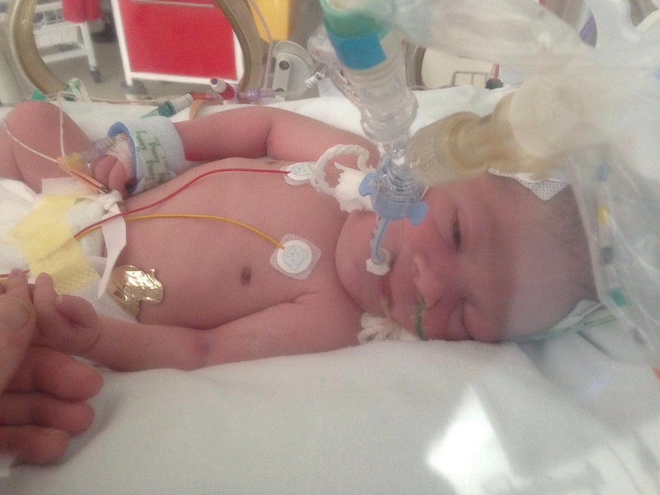  Remari was put into an induced coma after he was born for 72 hours