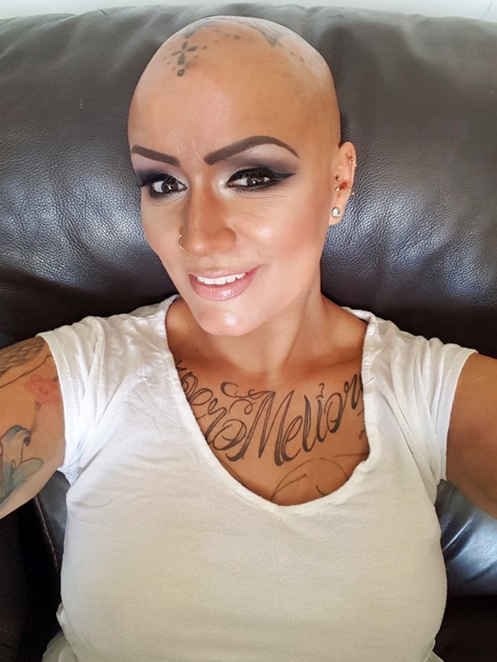  Michelle Moffatt after she was diagnosed proudly has a tattoo on her head to symbolise what she has been through