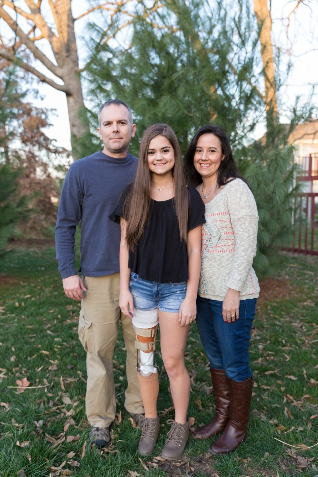 Dancing Queen: Amputee Ballerina Learns to Dance Again