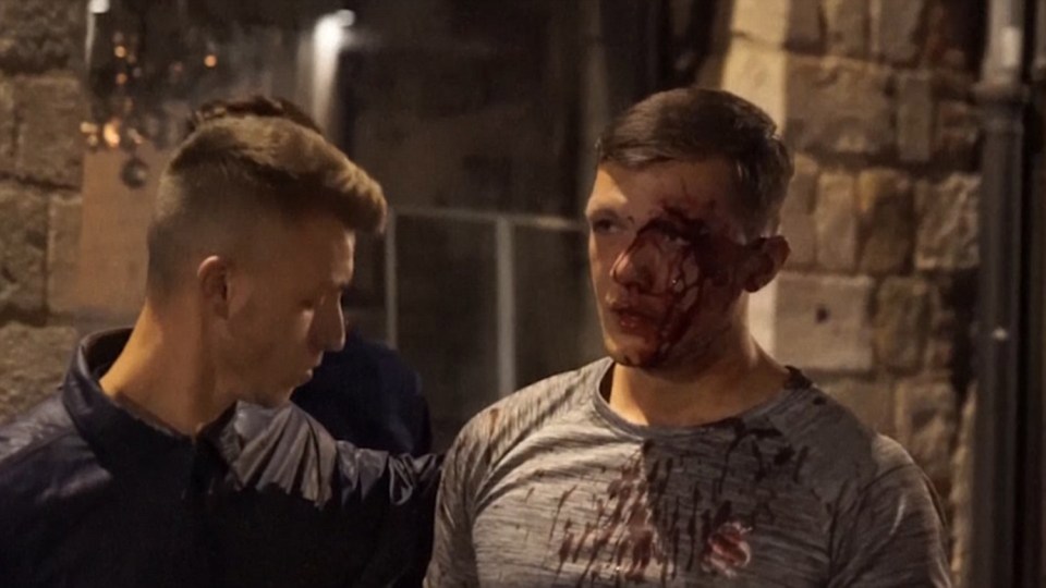  An England fan covered in blood after being attacked by Russian Ultras on the streets of Lille last night