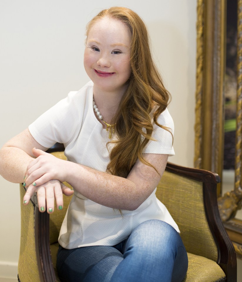 Madeline Stuart has Down's Syndrome and had to have heart surgery as a baby