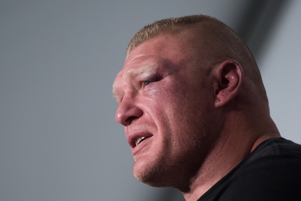 Brock Lesnar at the UFC 200 post-fight press conference