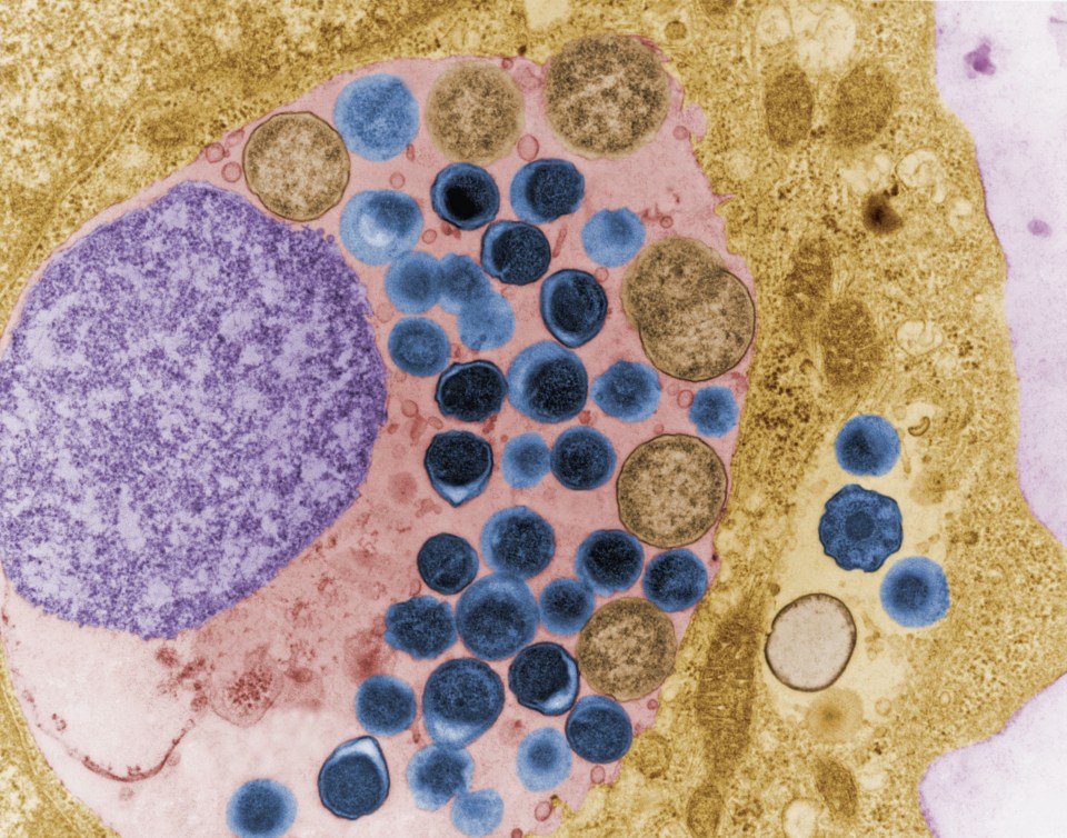  A cell infected with Chlamydia trachomatis bacteria