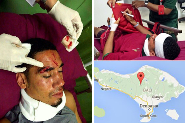 Chris Smalling hospitalised after being food poisoned and falling over and bashing his head