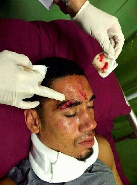  The extent to Chris Smalling's injury is revealed after he passed out in Bali