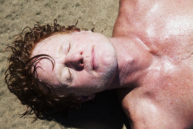 People with a ‘hidden’ ginger hair gene are officially more at risk of getting skin cancer