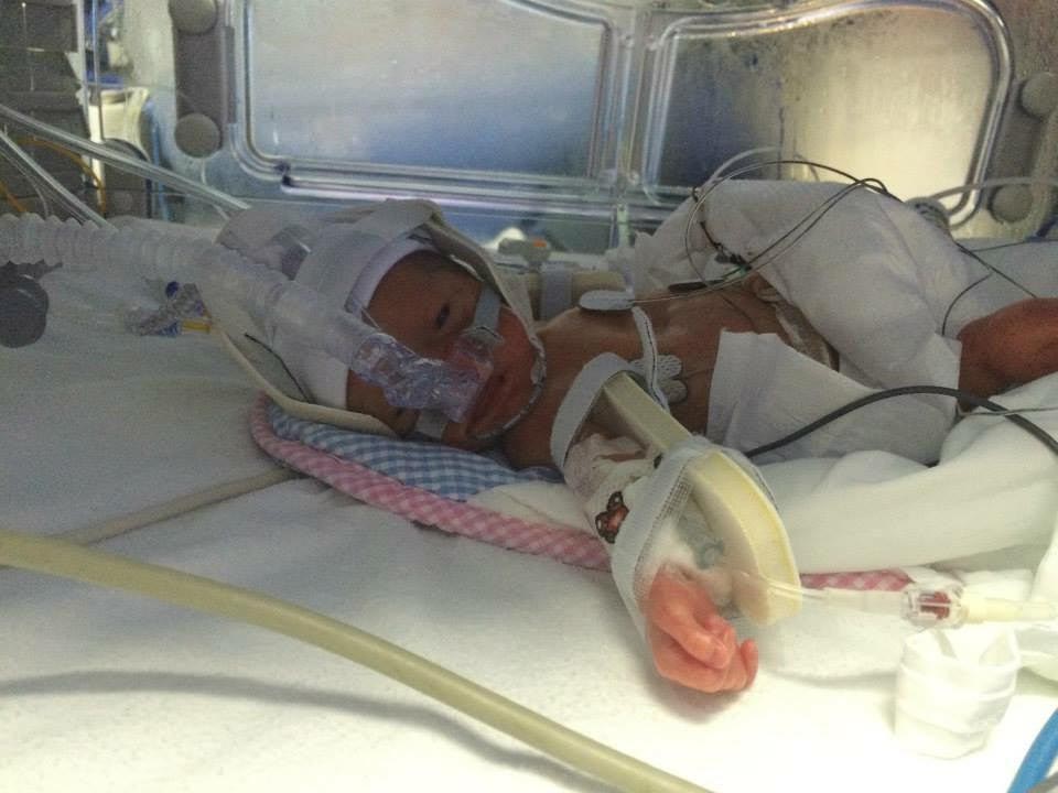  The tot spent 12 weeks in hospital