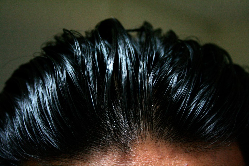 Is your hair greasy all the time?