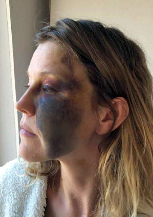  New mum Ashley Gebbie was savagely beaten by her partner Alan Crozier