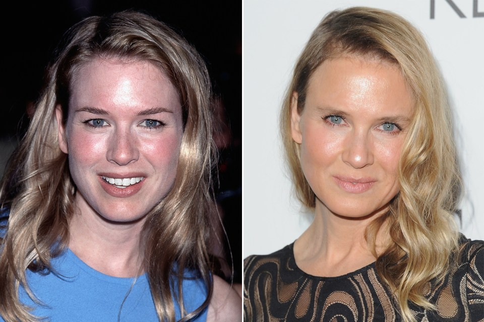  The shock transformation of Renée Zellweger has had tongues wagging