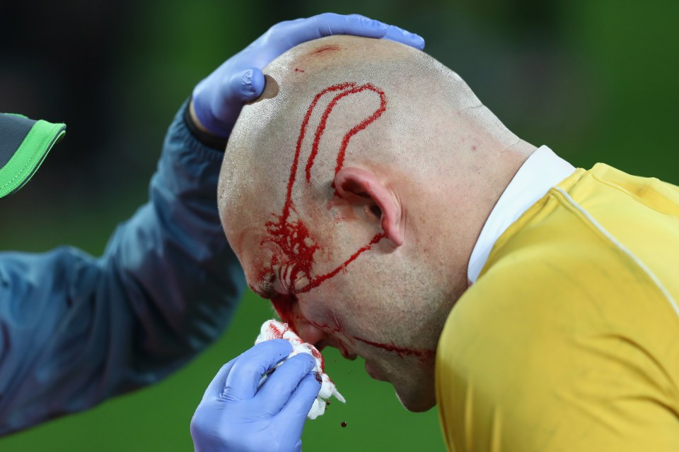 WELLINGTON, NEW ZEALAND - AUGUST 27: Stephen Moore of Australia is cut on the head during the Bledisloe Cup Rugby Championship match between the New Zealand All Blacks and the Australia Wallabies at Westpac Stadium on August 27, 2016 in Wellington, New Zealand. (Photo by Phil Walter/Getty Images)