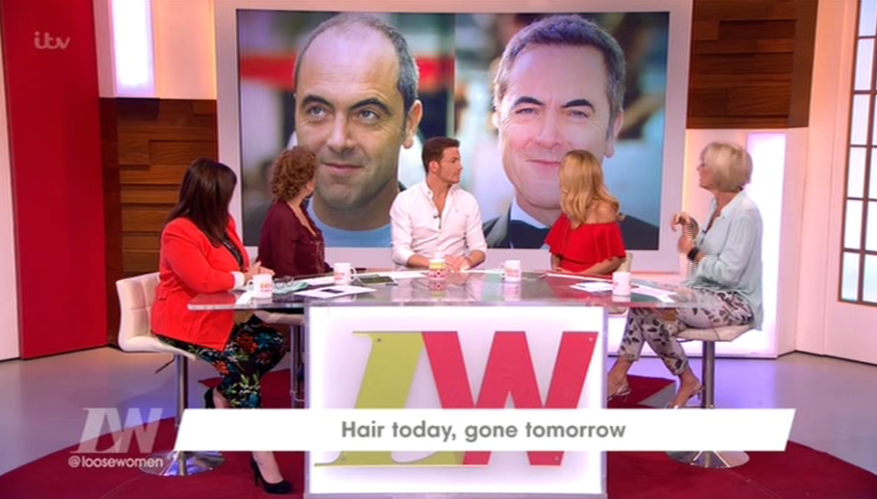  Joe said he wanted to keep it a secret but it was great that people like James Nesbitt are open about it