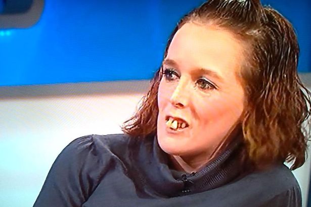  Jezza and his production team forked out for Gemma's teeth transformation