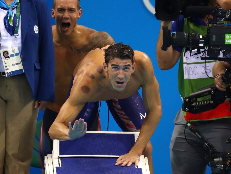  Michael Phelps won gold in 4x100m freestyle relay as fans spotted purple circles on his shoulders