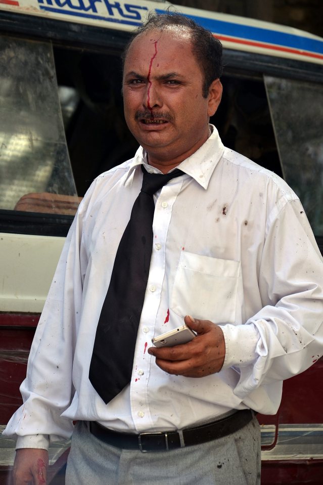  A lawyer who was injured in a bomb blast waits to receive medical treatment