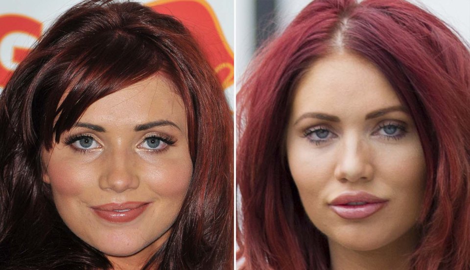 Amy Childs looking fresh-faced, left, and sporting her famous red hair, now