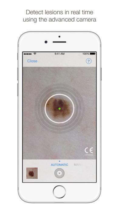  The app works by scanning freckles and moles to diagnose whether they could be cancerous