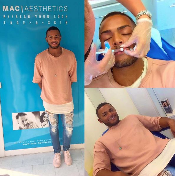 Nathan Henry has documented his lip filler injections on social media 