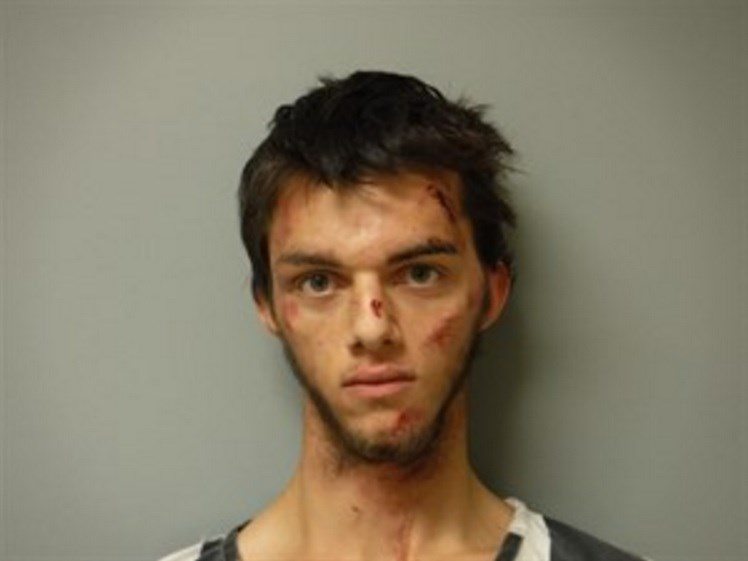  Suspect Logan Younger in his police mugshot following the crash