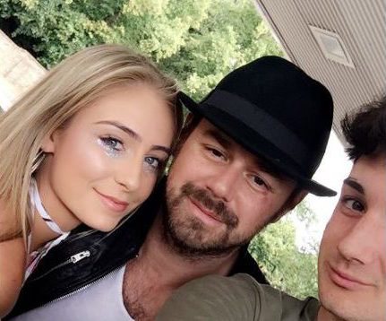  Aftermath...The bust-up left Danny Dyer with a black eye