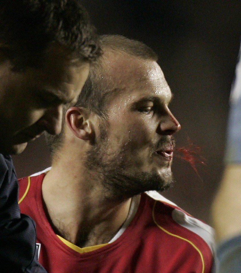 PIC; COPYRIGHT, HUGH ROUTLEDGE. 30.1.05. ARSENAL V MANCHESTER UNITED, PREMIERSHIP. FREDDIE LJUNGBERG AFTER BEING HEADBUTTED BY MIKAEL SILVESTRE