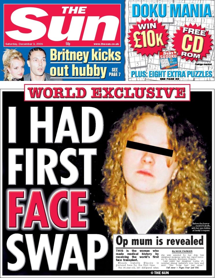 The Sun newspaper revealed Isabelle Dinoire's story to the world in 2005 with a front page splash on the groundbreaking face transplant 