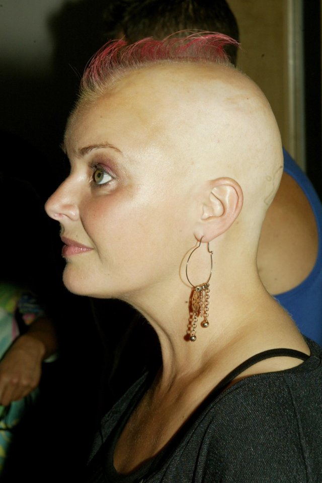 Gail Porter in 2005, shortly after her alopecia diagnosis