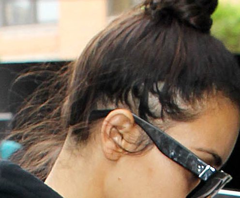  Kim's extension-less bun showed she has been struggling with hair loss