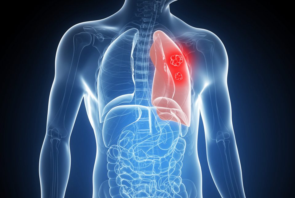 Scientists discovered compounds in the two spices work together to stop the growth of tumours in the lungs of mice