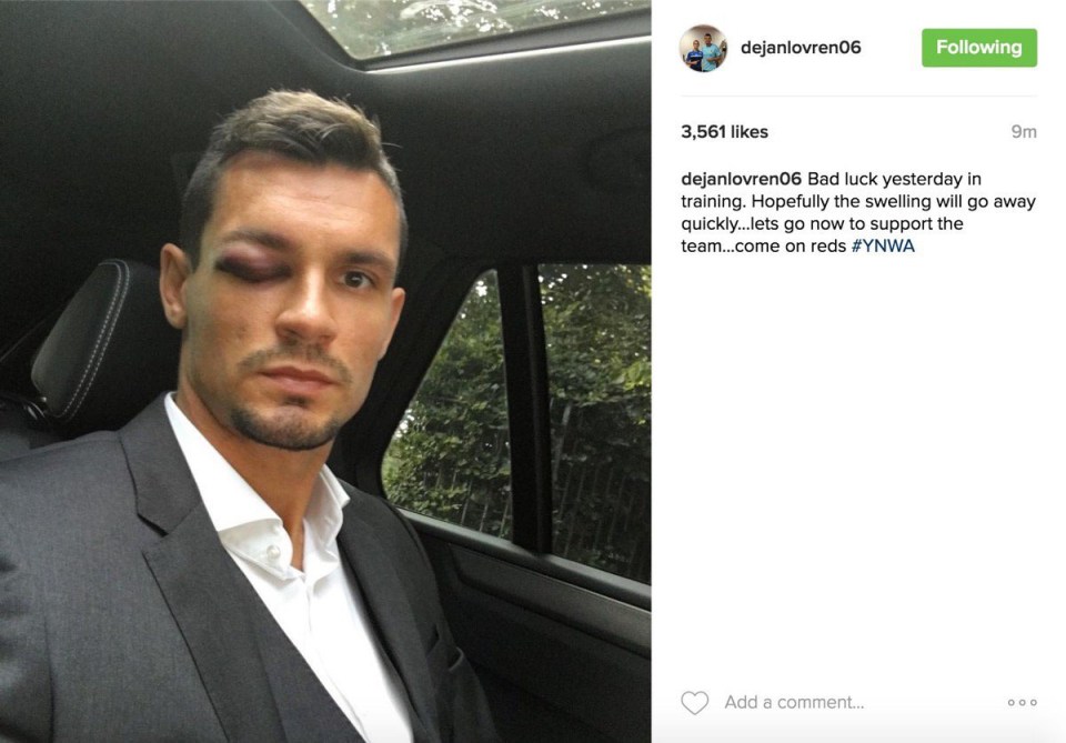 Lovren took to social media to share a photo of the horror injury he picked up in a training session