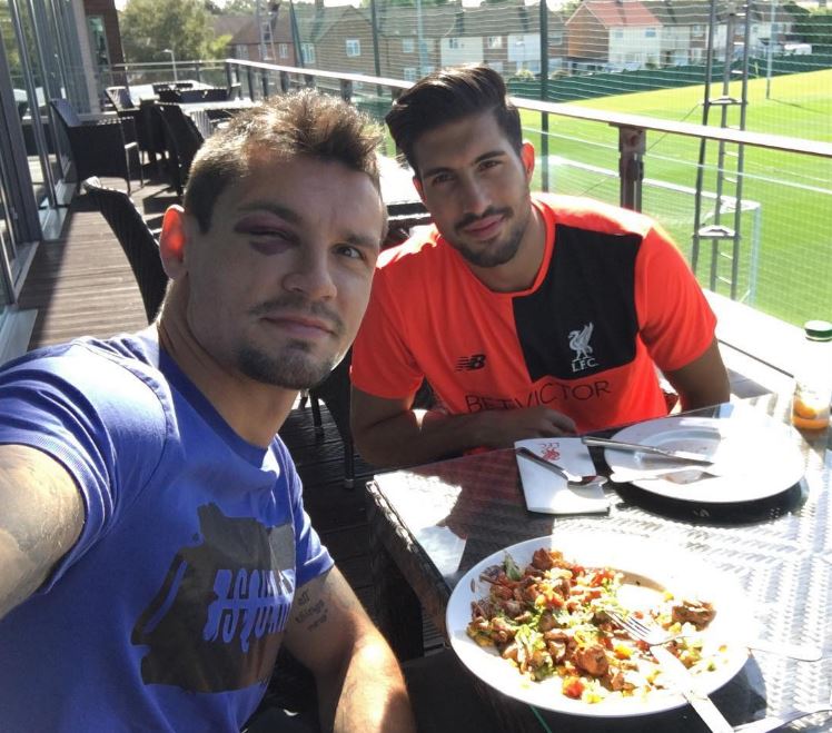 Lovren poses for a selfie with team-mate Emre Can, showing the badly bruised right eye