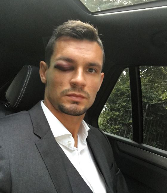 Dejan Lovren has revealed the horror injury that forced him to miss Liverpool's victory against Leicester at the weekend