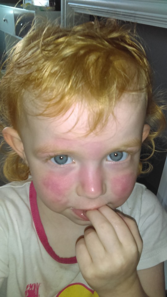 Hayley Neale's daughter Martha suffered a skin reaction to Aldi's Mamia Newborn wipes