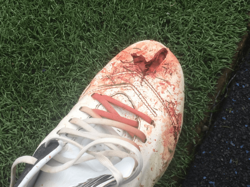 Stanley tweeted this photo of Seamus Conneely bloody boot